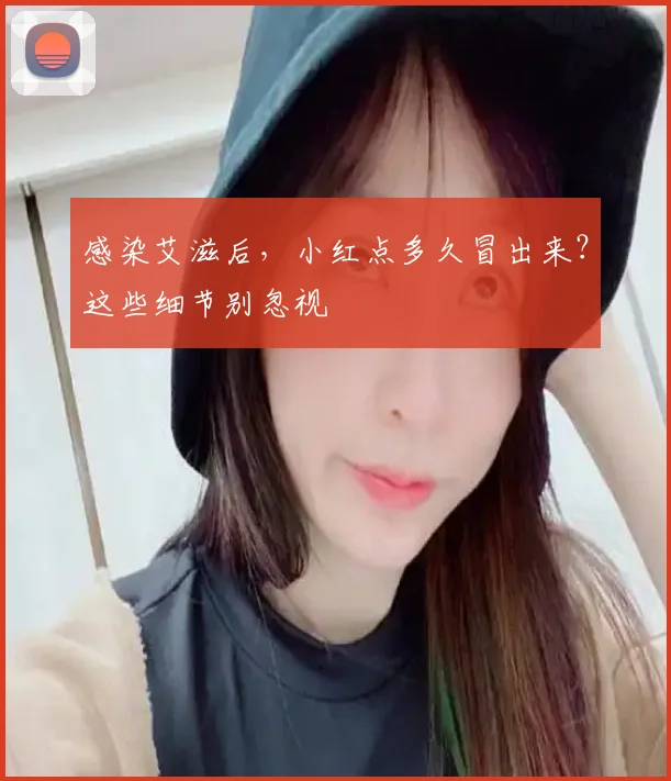 感染艾滋后，小红点多久冒出来？这些细节别忽视