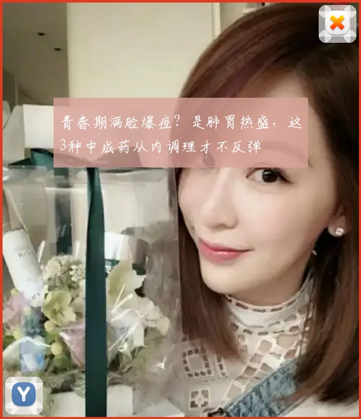 青春期满脸爆痘?是肺胃热盛,这3种中成药从内调理才不反弹